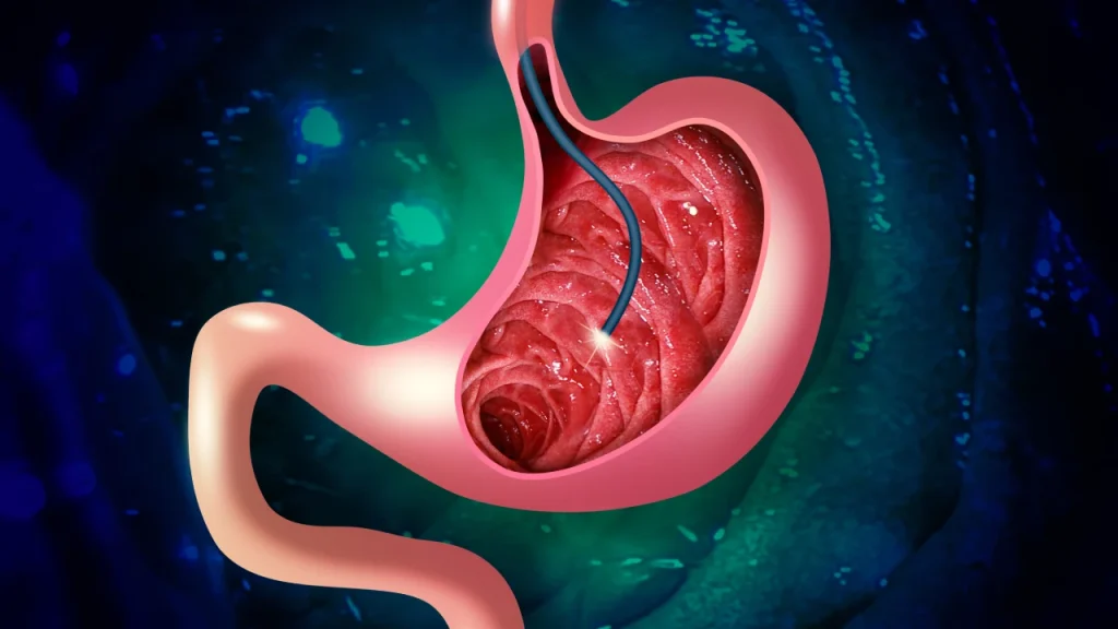 How an Endoscopy Clinic Singapore Helps Detect Early Gastric and Pancreatic Conditions
